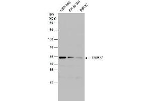 WB Image TRIM27 antibody detects TRIM27 protein by western blot analysis.