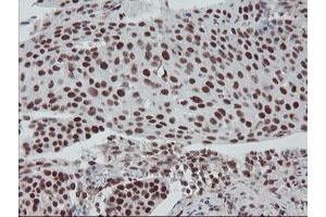 Image no. 3 for anti-TP53RK Binding Protein (TPRKB) antibody (ABIN1501484)