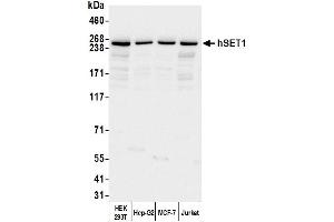 Western Blotting (WB) image for anti-hSET1 (AA 1200-1250) antibody (ABIN7449888) (hSET1 (AA 1200-1250) antibody)