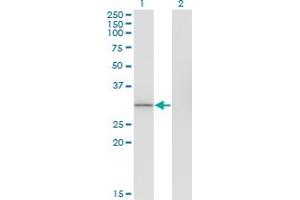 Western Blot analysis of FBXO6 expression in transfected 293T cell line by FBXO6 monoclonal antibody (M02A), clone 7D1. (FBXO6 antibody  (AA 1-293))