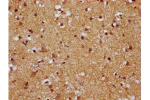 IHC image of ABIN7164031 diluted at 1:500 and staining in paraffin-embedded human brain tissue performed on a Leica BondTM system. (HCN1 antibody  (AA 784-887))