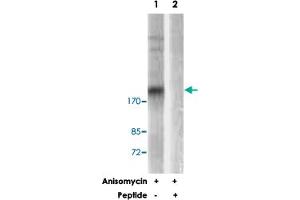 Western blot analysis of extracts from HeLa cells, treated with Anisomycin (25 ug/mL, 30 mins), using TSC2 polyclonal antibody . (Tuberin antibody)