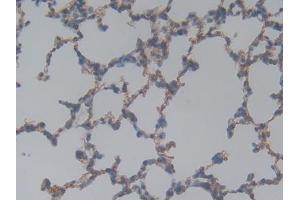 DAB staining on IHC-P; Samples: Rat Lung Tissue (Laminin gamma 1 antibody  (AA 1283-1551))