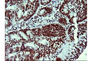 Image no. 1 for anti-Tumor Protein P73 (TP73) (AA 167-409) antibody (ABIN1491005) (Tumor Protein p73 antibody  (AA 167-409))