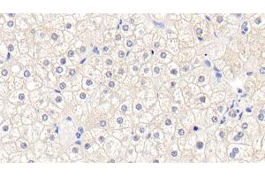 Detection of GSTM1 in Human Liver Tissue using Polyclonal Antibody to Glutathione S Transferase Mu 1 (GSTM1) (GSTM1 antibody  (AA 1-218))