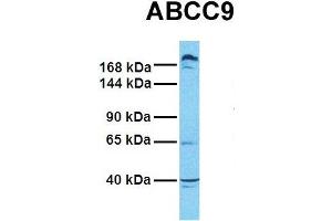 Host:  Rabbit  Target Name:  ABCC9  Sample Tissue:  Human PANC1  Antibody Dilution:  1. (ABCC9 antibody  (Middle Region))