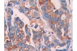 Used in DAB staining on fromalin fixed paraffin- embedded kidney tissue (LOXL4 antibody  (AA 399-552))