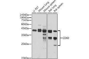 Western blot analysis of extracts of various cell lines, using CD69 antibody (ABIN3022774, ABIN3022775, ABIN3022776 and ABIN6219223) at 1:1000 dilution.