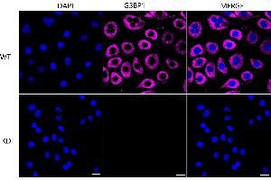 Immunocytochemical staining of HeLa cells using G3BP1 antibody (ABIN7798815), 1:1,000), Top panel: wild-type (WT), Bottom panal: G3BP1 shRNA knockdown (KD).
