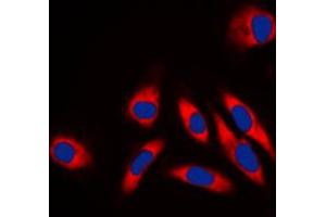 Immunofluorescent analysis of HSP60 staining in NIH3T3 cells. (HSPD1 antibody  (C-Term))