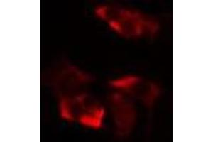 ABIN6277116 staining  HepG2 cells by IF/ICC. (XRCC3 antibody  (N-Term))