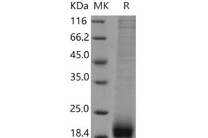 Western Blotting (WB) image for Agouti Related Protein Homolog (Mouse) (AGRP) protein (His tag) (ABIN7194187) (AGRP Protein (His tag))