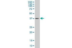 TFDP3 monoclonal antibody (M02), clone 3F11 Western Blot analysis of TFDP3 expression in IMR-32 . (TFDP3 antibody  (AA 1-100))