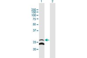 Western Blot analysis of GADD45GIP1 expression in transfected 293T cell line by GADD45GIP1 MaxPab polyclonal antibody. (GADD45GIP1 antibody  (AA 1-222))