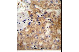 NDST1 Antibody (C-term) (ABIN657148 and ABIN2846284) immunohistochemistry analysis in formalin fixed and paraffin embedded human liver tissue followed by peroxidase conjugation of the secondary antibody and DAB staining. (NDST1 antibody  (C-Term))