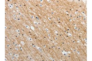 The image on the left is immunohistochemistry of paraffin-embedded Human brain tissue using ABIN7189659(ADAMTS19 Antibody) at dilution 1/25, on the right is treated with synthetic peptide.
