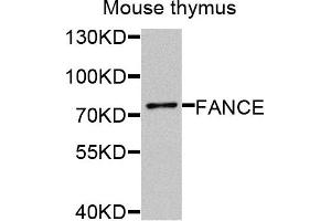 Western blot analysis of extracts of mouse thymus cells, using FANCE antibody.