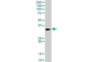 TOLLIP MaxPab rabbit polyclonal antibody. (TOLLIP antibody  (AA 1-274))