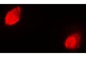 Immunofluorescent analysis of RACK1 staining in Hela cells. (GNB2L1 antibody)