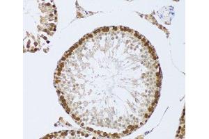Immunohistochemistry of paraffin-embedded Mouse testis using CIRBP Polyclonal Antibody at dilution of 1:100 (20x lens).