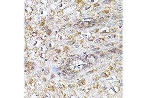 Immunohistochemistry (Paraffin-embedded Sections) (IHC (p)) image for anti-Cholesteryl Ester Transfer Protein (CETP) (AA 300-493) antibody (ABIN3021919)