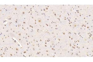 Immunohistochemistry (IHC) image for anti-Nucleolin (NCL) (AA 353-568) antibody (ABIN7434776)