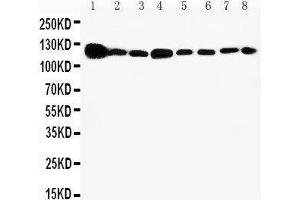 Western Blotting (WB) image for anti-Vinculin (VCL) (AA 173-188), (N-Term) antibody (ABIN3044168)