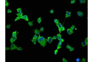 Immunofluorescence staining of SH-SY5Y cells with ABIN7169916 at 1:66, counter-stained with DAPI. (SCN1A antibody  (AA 992-1099))
