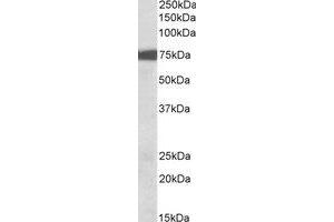Western Blotting (WB) image for anti-Ribosomal Protein S6 Kinase, 90kDa, Polypeptide 2 (RPS6KA2) (C-Term) antibody (ABIN2464829) (RPS6KA2 antibody  (C-Term))