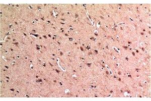 Immunohistochemistry of paraffin-embedded Human brain tissue using BECN1 Monoclonal Antibody at dilution of 1:200. (Beclin 1 antibody)
