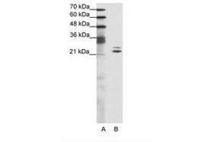 Image no. 1 for anti-BUD31 Homolog (BUD31) (AA 71-120) antibody (ABIN202030)