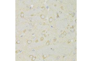 Immunohistochemistry of paraffin-embedded rat brain using TRAP1 Antibody (ABIN1875197) at dilution of 1:100 (40x lens). (TRAP1 antibody)