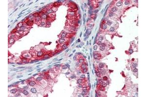 Human Prostate (formalin-fixed, paraffin-embedded) stained with SKP2at 10 µg/ml followed by biotinylated goat anti-rabbit IgG secondary antibody, alkaline phosphatase-streptavidin and chromogen. (SKP2 antibody  (AA 221-425))