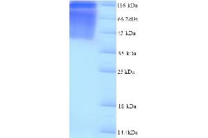SDS-PAGE (SDS) image for Dihydropyrimidinase-Like 2 (DPYSL2) (AA 1-572), (full length) protein (His tag) (ABIN5714316)