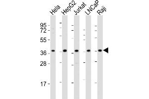 All lanes : Anti-DFFB Antibody (N-term) at 1:2000 dilution Lane 1: Hela whole cell lysates Lane 2: HepG2 whole cell lysates Lane 3: Jurkat whole cell lysates Lane 4: LNCaP whole cell lysates Lane 5: Raji whole cell lysates Lysates/proteins at 20 μg per lane. (DFFB antibody  (N-Term))