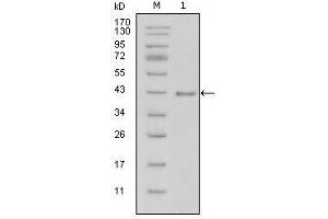 Western blot analysis using LAMB1 mouse mAb against truncated LAMB1-His recombinant protein (1). (Laminin beta 1 antibody  (AA 31-270))