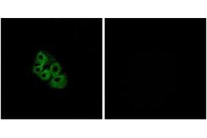 Immunofluorescence analysis of A549 cells, using LSHR Antibody. (LHCGR antibody  (AA 621-670))