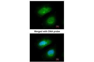 ICC/IF Image Immunofluorescence analysis of paraformaldehyde-fixed HeLa, using PRAK, antibody at 1:200 dilution. (MAPKAP Kinase 5 antibody)