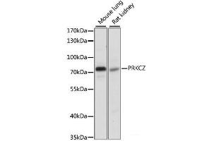 Western blot analysis of extracts of various cell lines using PRKCZ Polyclonal Antibody at dilution of 1:1000. (PKC zeta antibody)