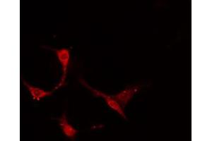 ABIN6274159 staining A549 cells by IF/ICC. (TACSTD2 antibody  (Internal Region))