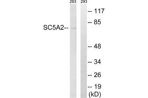 Western blot analysis of extracts from 293 cells, using SLC5A2 antibody. (SLC5A2 antibody  (Internal Region))