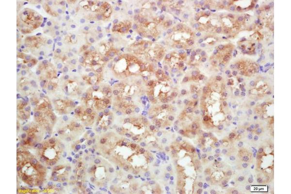 DAB2 antibody  (AA 31-130)