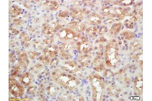 Formalin-fixed and paraffin embedded mouse kidney labeled with Rabbit Anti DAB2 Polyclonal Antibody, Unconjugated (ABIN760961) at 1:200 followed by conjugation to the secondary antibody and DAB staining