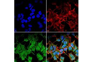 Immunocytochemistry/Immunofluorescence analysis using Mouse Anti-Kir6.