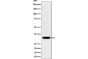 Western blot analysis of TSFM expression in Jurkat cell lysate. (Recombinant TSFM antibody)