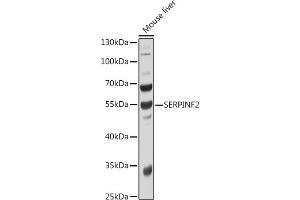 Western blot analysis of extracts of Mouse liver, using SERPINF2 antibody  at 1:1000 dilution. (alpha 2 Antiplasmin antibody  (AA 302-491))