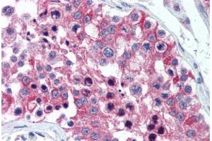 Human Testis (formalin-fixed, paraffin-embedded) stained with IL20RA antibody ABIN305719 at 10 ug/ml followed by biotinylated goat anti-rabbit IgG secondary antibody ABIN481713, alkaline phosphatase-streptavidin and chromogen. (IL20RA antibody  (AA 159-175))