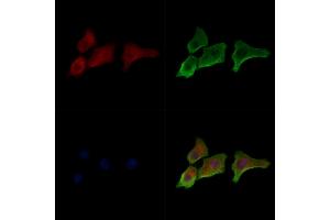 Phospho-Mitofusin 2 (Ser442) Antibody staining HepG2 cells(serum starvation treatment) by IF/ICC.