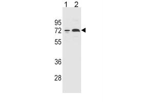Western Blotting (WB) image for anti-Cytochrome P450, Family 2, Subfamily B, Polypeptide 6 (CYP2B6) antibody (ABIN5015645) (CYP2B6 antibody)