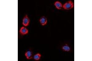 Immunofluorescent analysis of GPR87 staining in HuvEc cells. (GPR87 antibody)